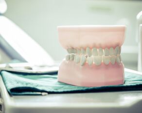 Vorteile von Implantaten