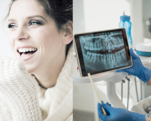 Wie lange halten wurzelbehandelte Zähne eigentlich?